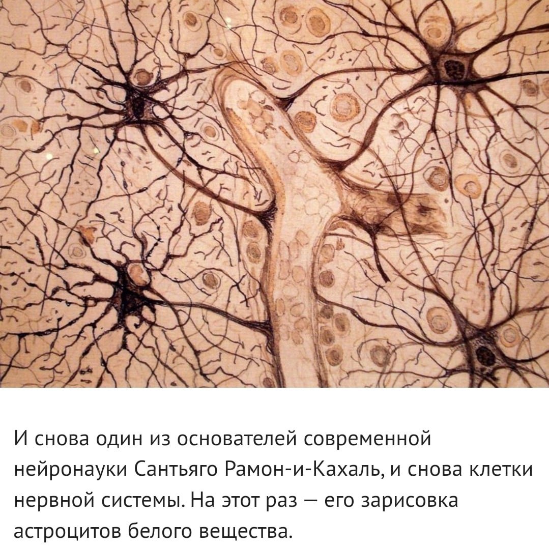 Как называются клетки головного мозга