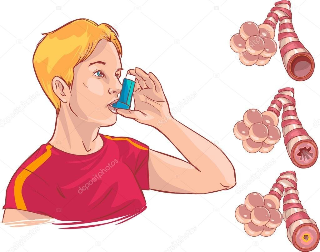 Постер астма. Человек с астмой. Бронхиальная астма. Человек с бронхиальной астмой. Бронхиальная астма иллюстрации.
