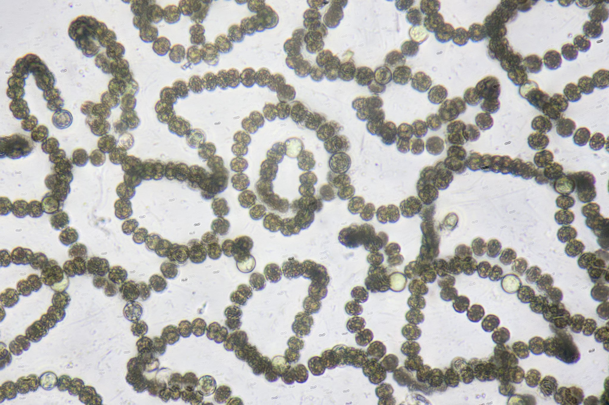 Клетки водорослей и цианобактерий. Цианобактерии носток. Цианобактерия Анабена. Носток водоросль. Anabaena цианобактерия.