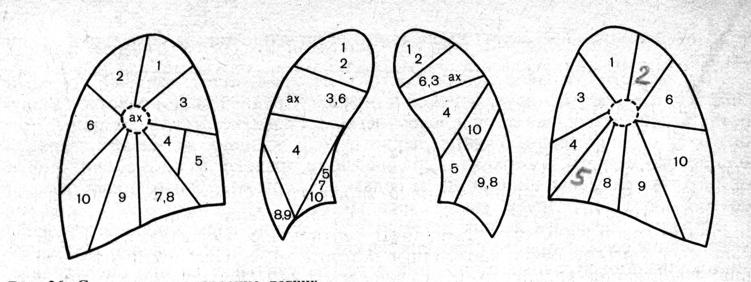 Сегменты картинки. 5 Сегмент легкого. Сегментарное тстроение лёгких. Сегменты легкого топографическая анатомия. Сегментарное строение легких.