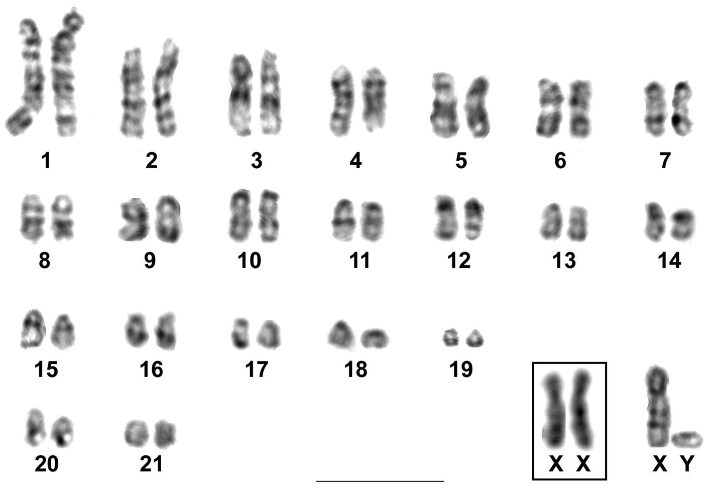 Х хромосома это мужская. XY хромосомы. Кариотип обыкновенная бурозубка. Кариотип человека под микроскопом. XY хромосомы мужские.
