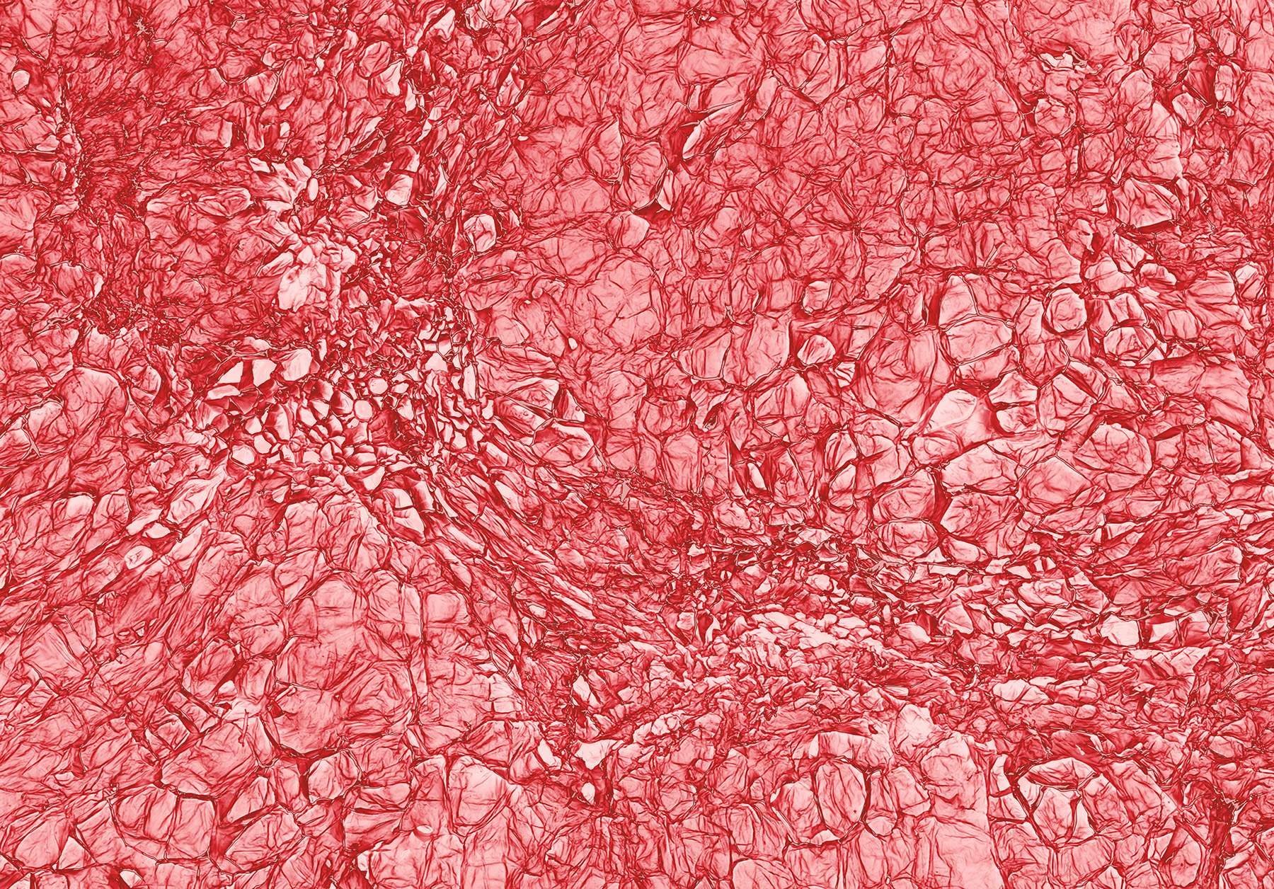 Клетки рябины под микроскопом
