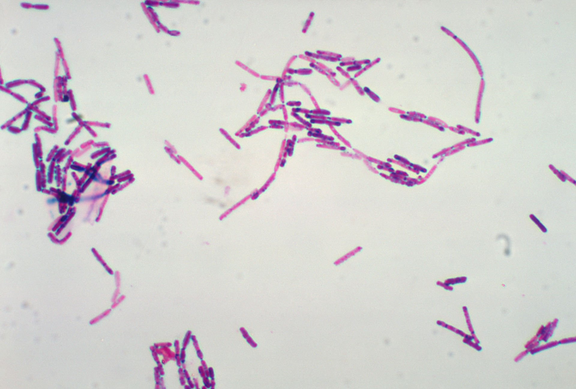 Микропрепарат бактерий. Bacillus subtilis микроскопия. Сенная палочка микроскопия. Bacillus Cereus микроскопия. Bacillus subtilis Граму.