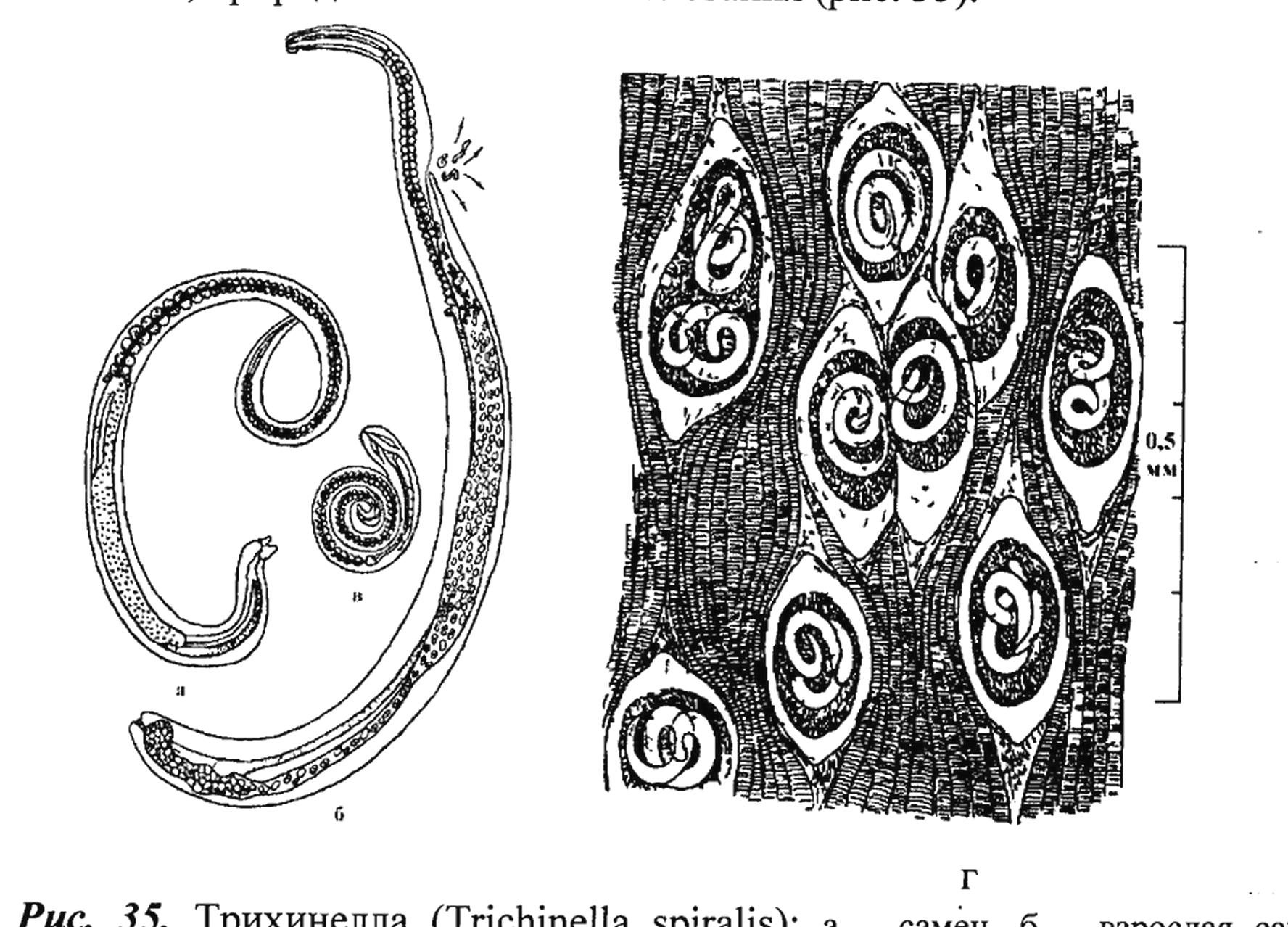 Личинки трихинеллы. Трихинелла (Trichinella spiralis). Трихинелла самка и самец.