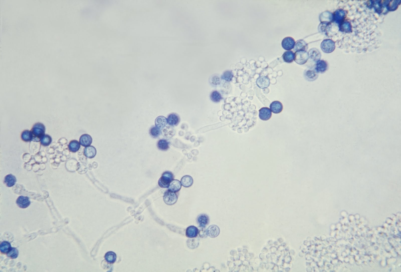 Споры candida. Candida альбиканс. Грибы кандида альбиканс микроскопия. Кандида альбиканс под микроскопом. Хламидоспоры кандида.