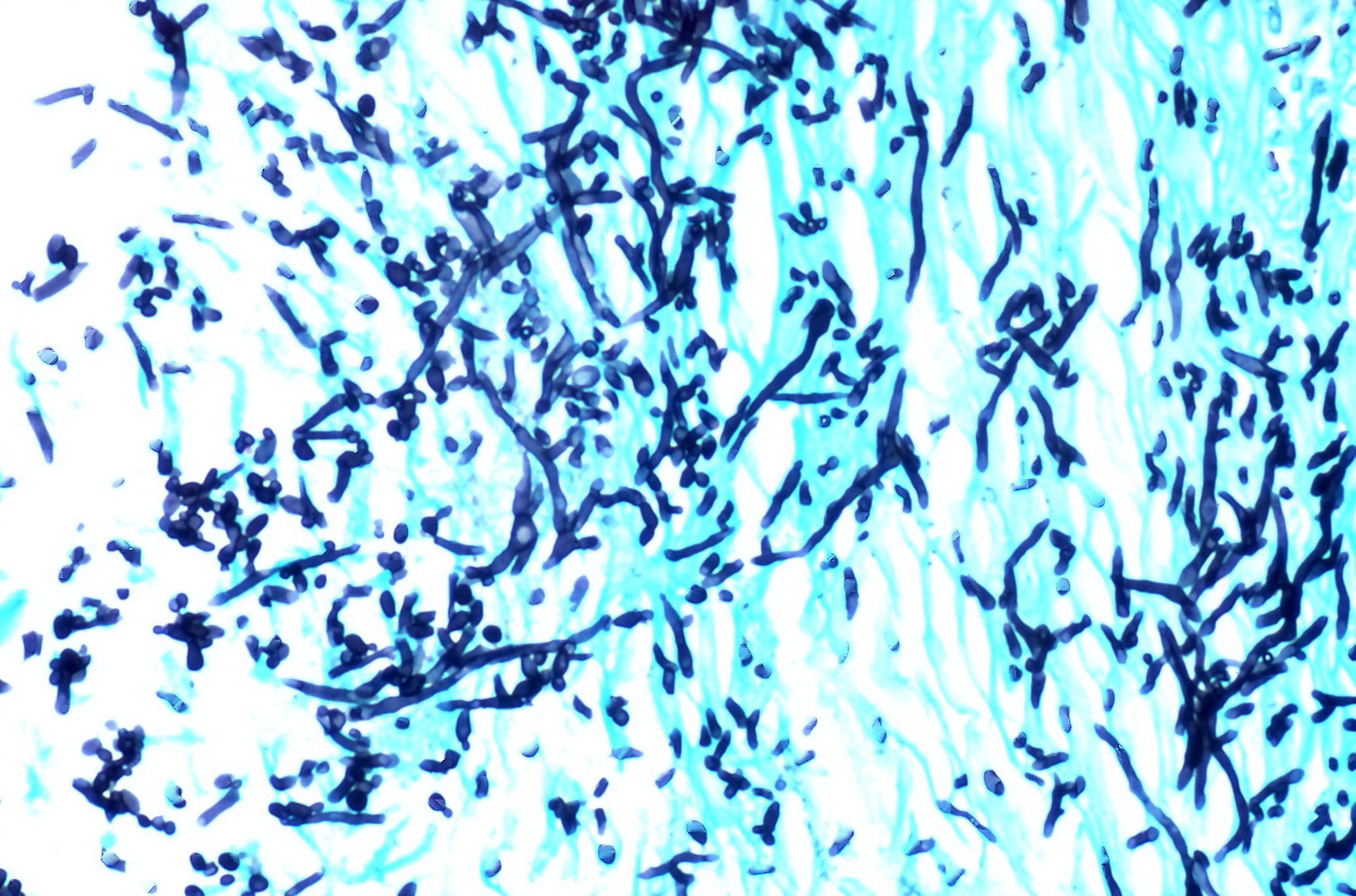 Молочница гриб. Грибы кандида микроскопия. Кандида альбиканс микроскопия. Candida Auris микроскопия. Candida мазок.