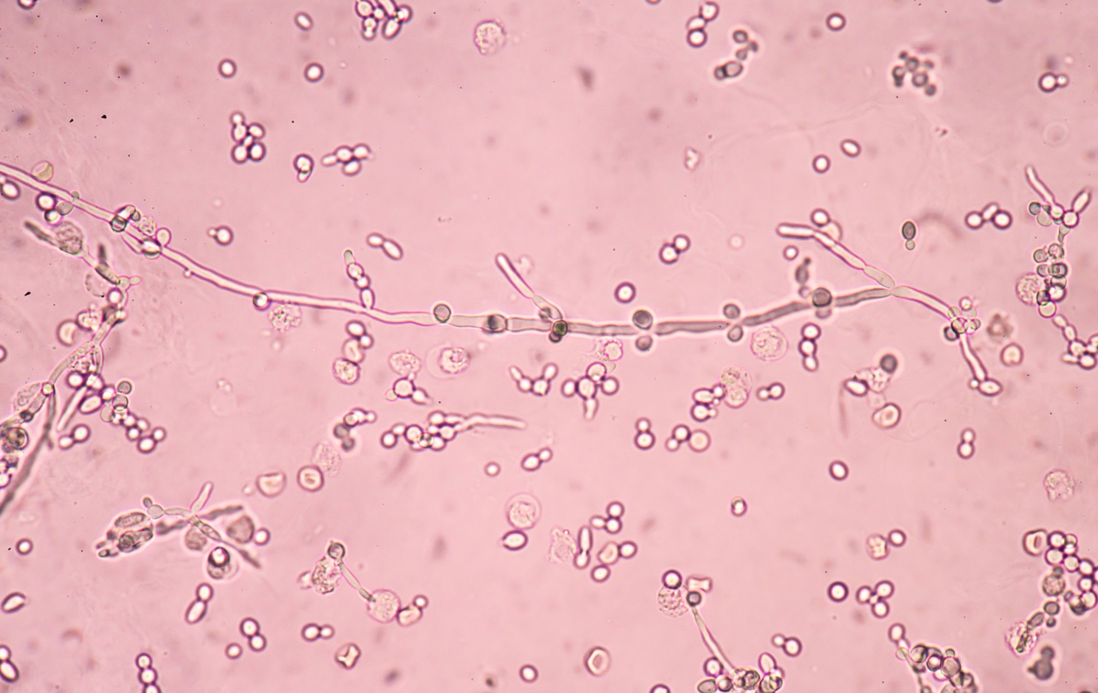 Молочница бактерии. Candida дрожжевые клетки псевдомицелий. Грибы кандида микроскопия. Candida albicans почкующиеся клетки. Кандида бактерия под микроскопом.