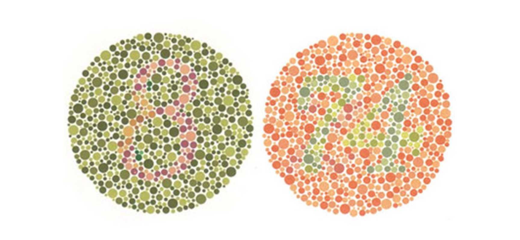 Ген общей цветовой слепоты. Дихромат дальтонизм. Таблица Рабкина зеленый красный. Тританопический дальтонизм. Приобретенный дальтонизм.