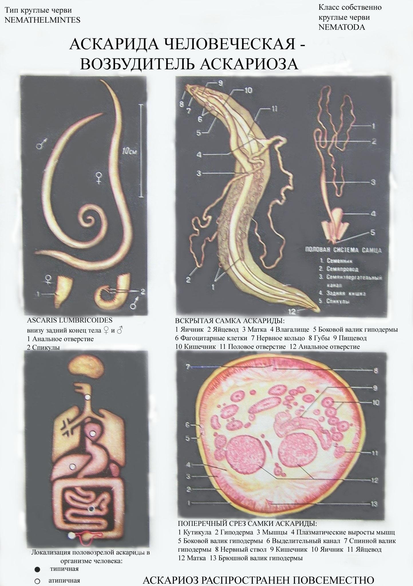 В каких органах личинки аскариды. Круглые черви аскарида человеческая. Тип круглые черви аскарида человеческая.
