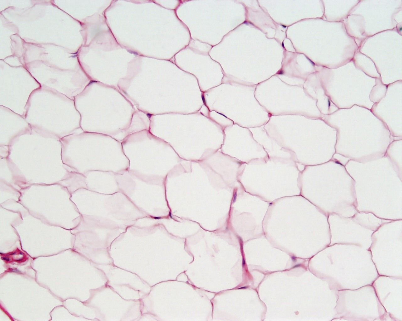 Жировая ткань латынь. Жировая ткань ткань гистология. Белая жировая ткань под микроскопом. Жировая ткань гистология. Клетки жировой ткани гистология.