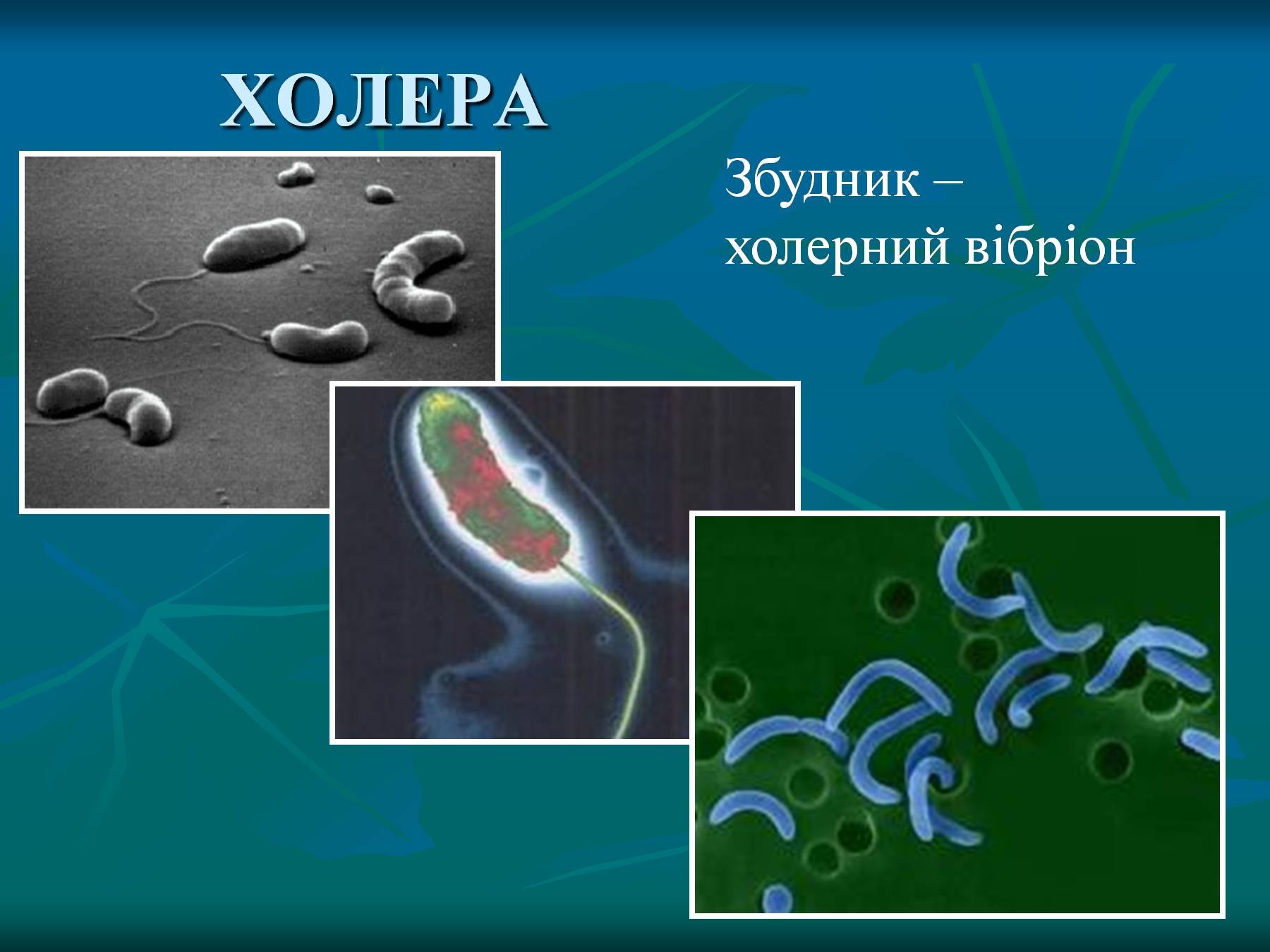 Холера класс. Сообщение про бактерию вибрион. Холера бактерия. Болезнетворные бактерии холера.