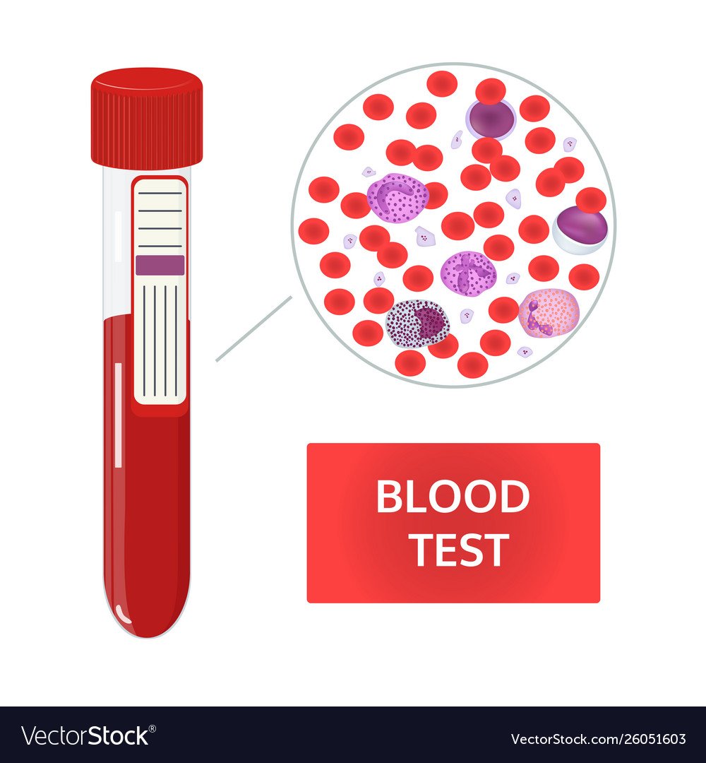 Тест клетки крови. Анализ крови рисунок. Анализ крови векторное изображение. Исследование крови векторный рисунок. Общий анализ крови рисунок.