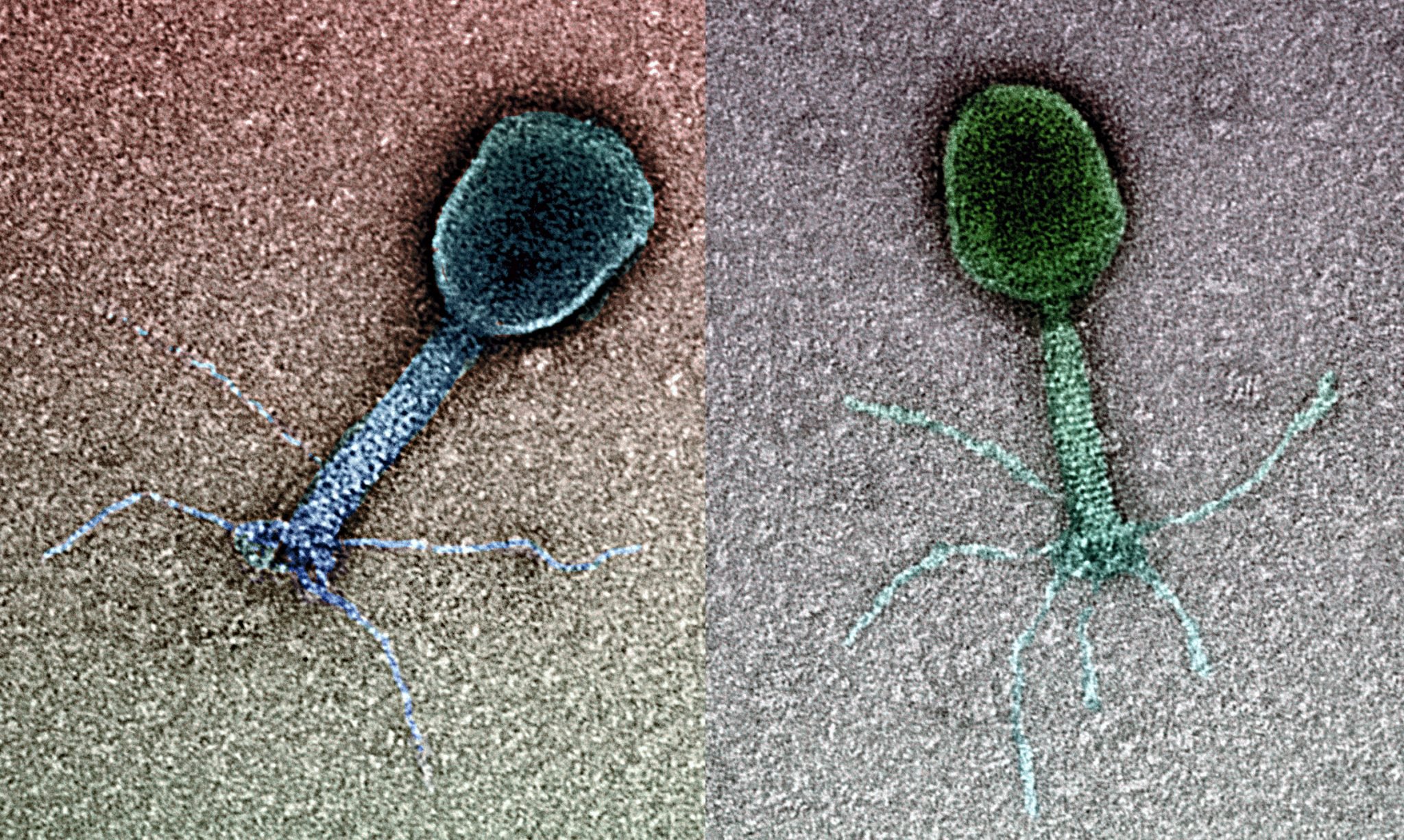 Kinito pet вирус. ПРОТИВОХОЛЕРНЫЙ бактериофаг. Холерный бактериофаг. Вирусы бактерий бактериофаги. Бактериофаг микроскопия.