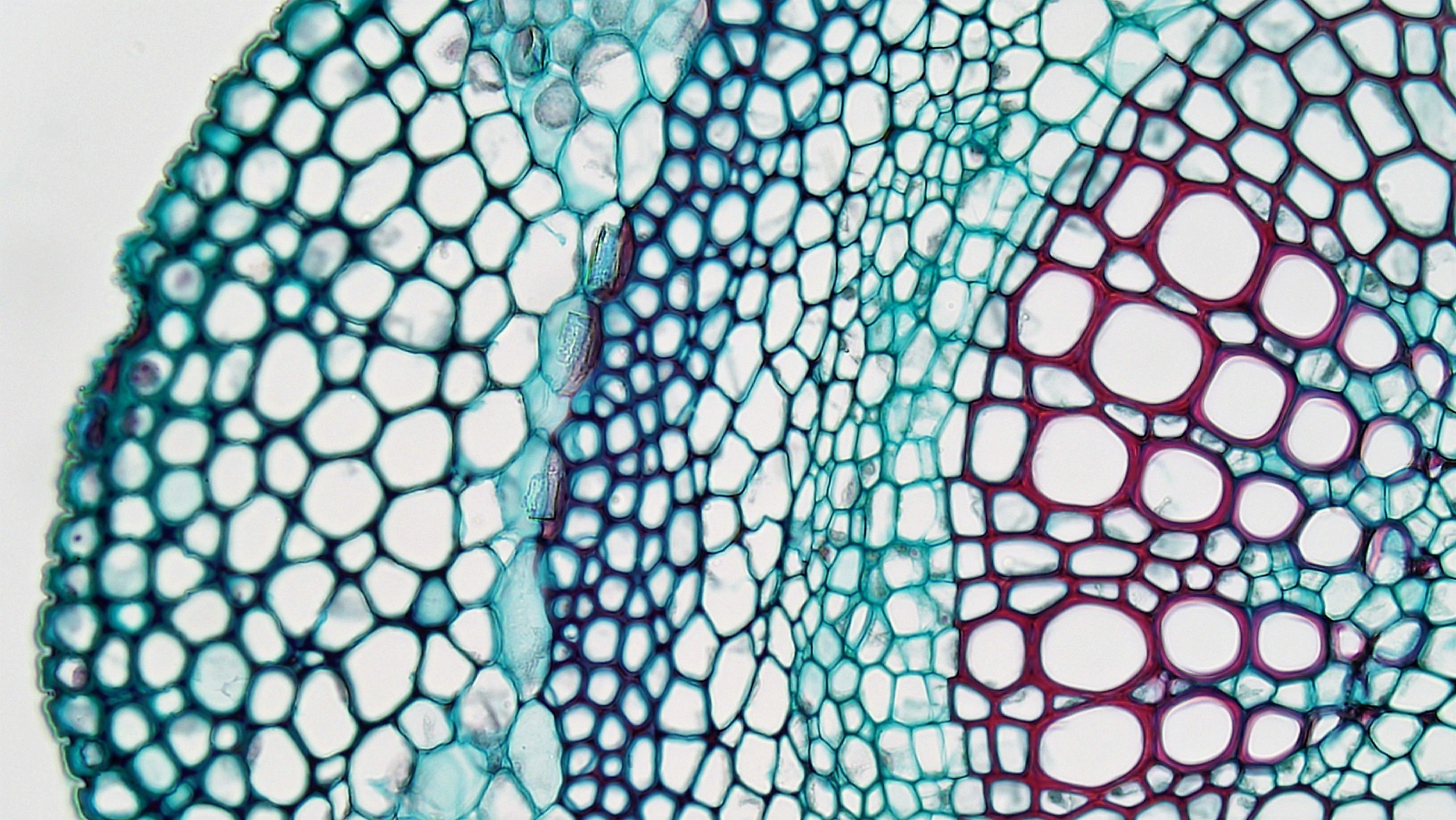 Флоэма рисунок. Клетки склеренхимы. Склеренхима ткани растений. Колленхима и склеренхима. Ксилема микроскоп.