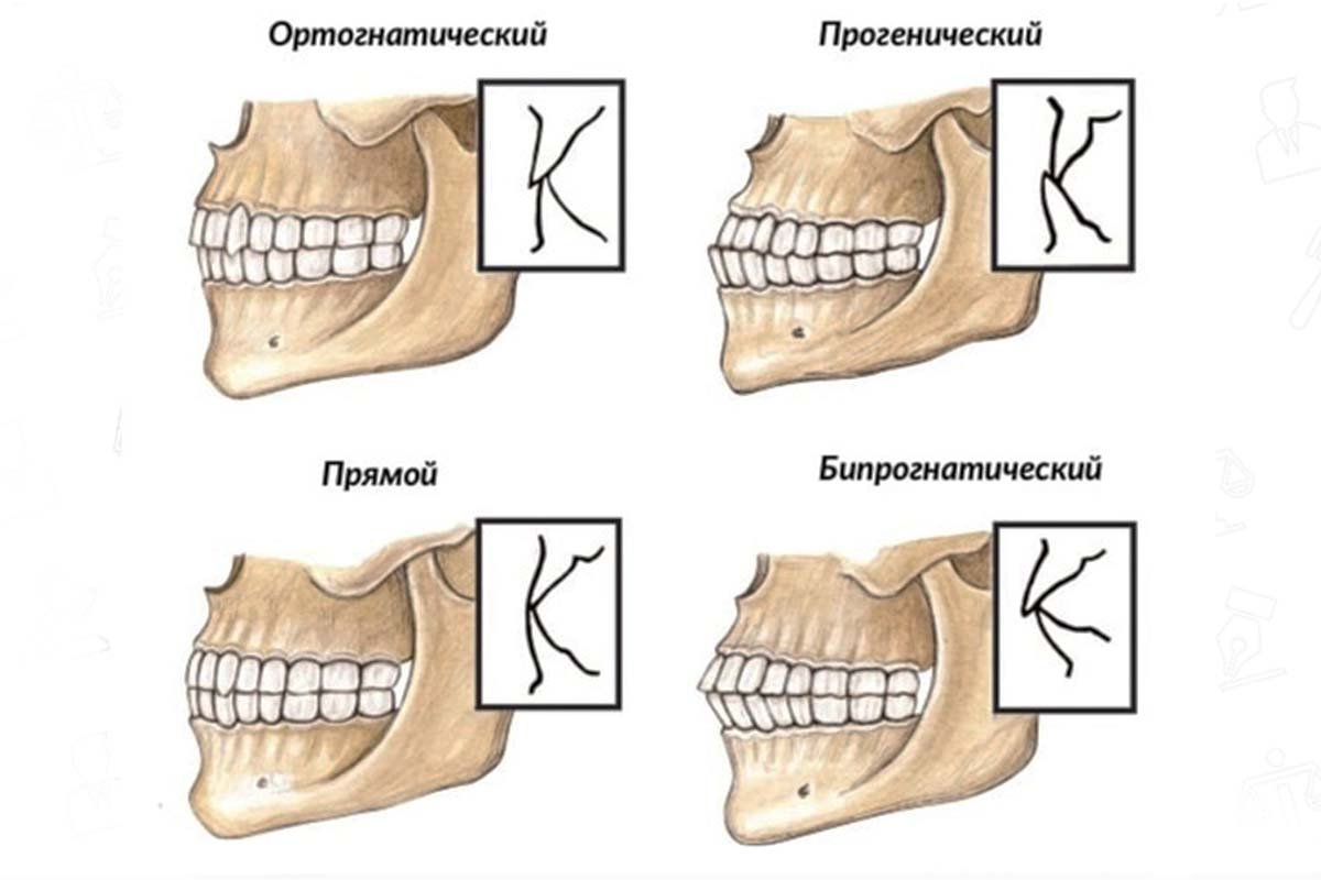 Почему сжата челюсть. Правильное расположение челюсти сбоку. Правильный прикус зубов сбоку. Ортогнатический прикус для передних зубов. Ортогнатический прикус постановка зубов.