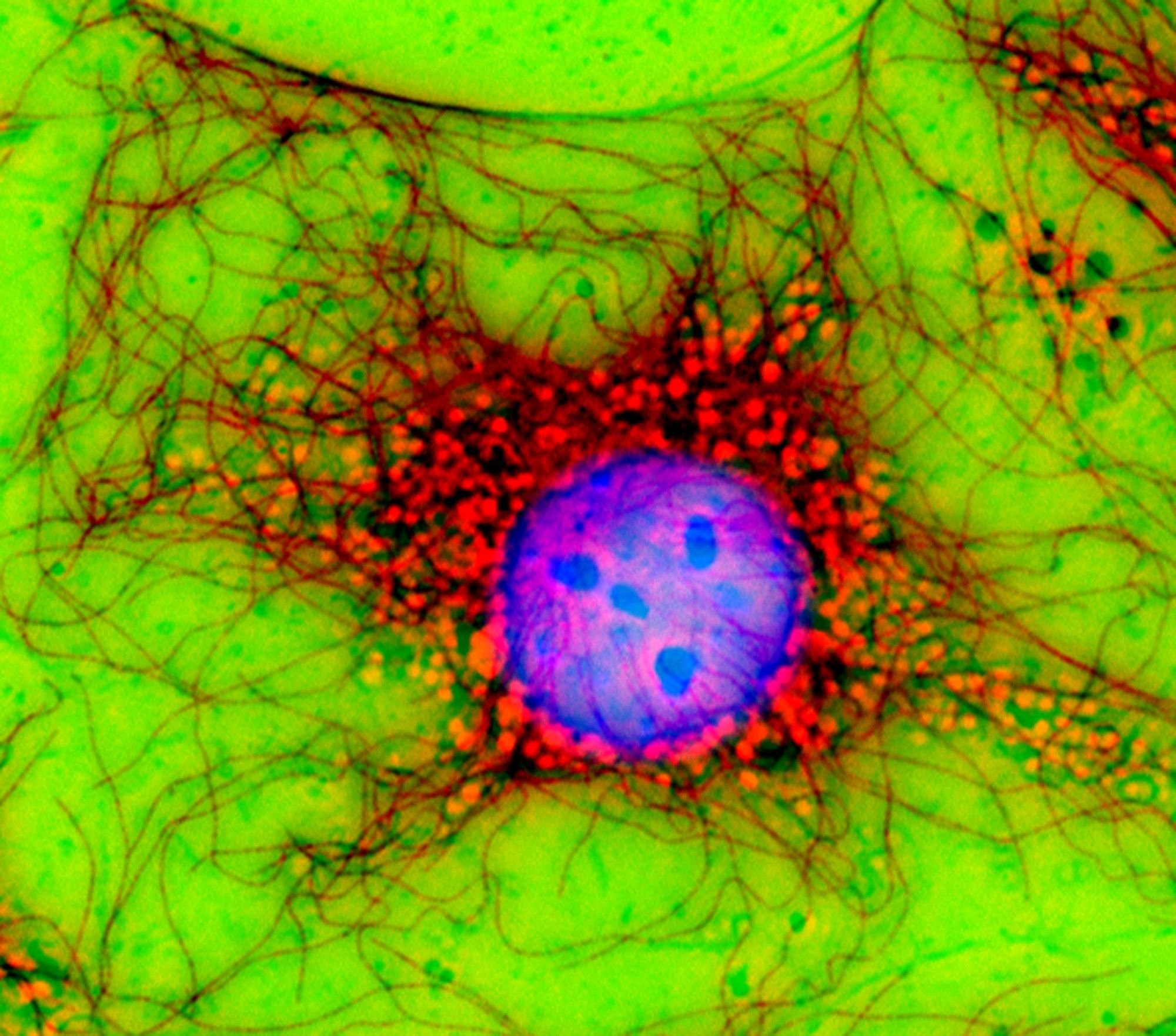 Клетки с гиперхромными ядрами. Цитоскелет флуоресцентная микроскопия. Цитоскелет клетки в микроскопе. Митоз флуоресцентная микроскопия. Цитоскелет микрофотография.