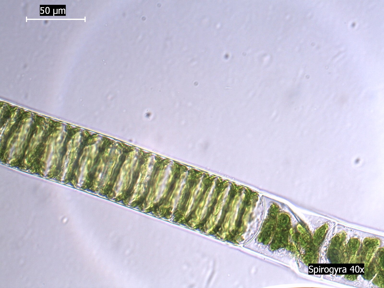 Спирогира отдел. Спирогира в микроскопе. Спирогира водоросль. Спирогира микроскоп 10x. Спирогира микроскоп 10.