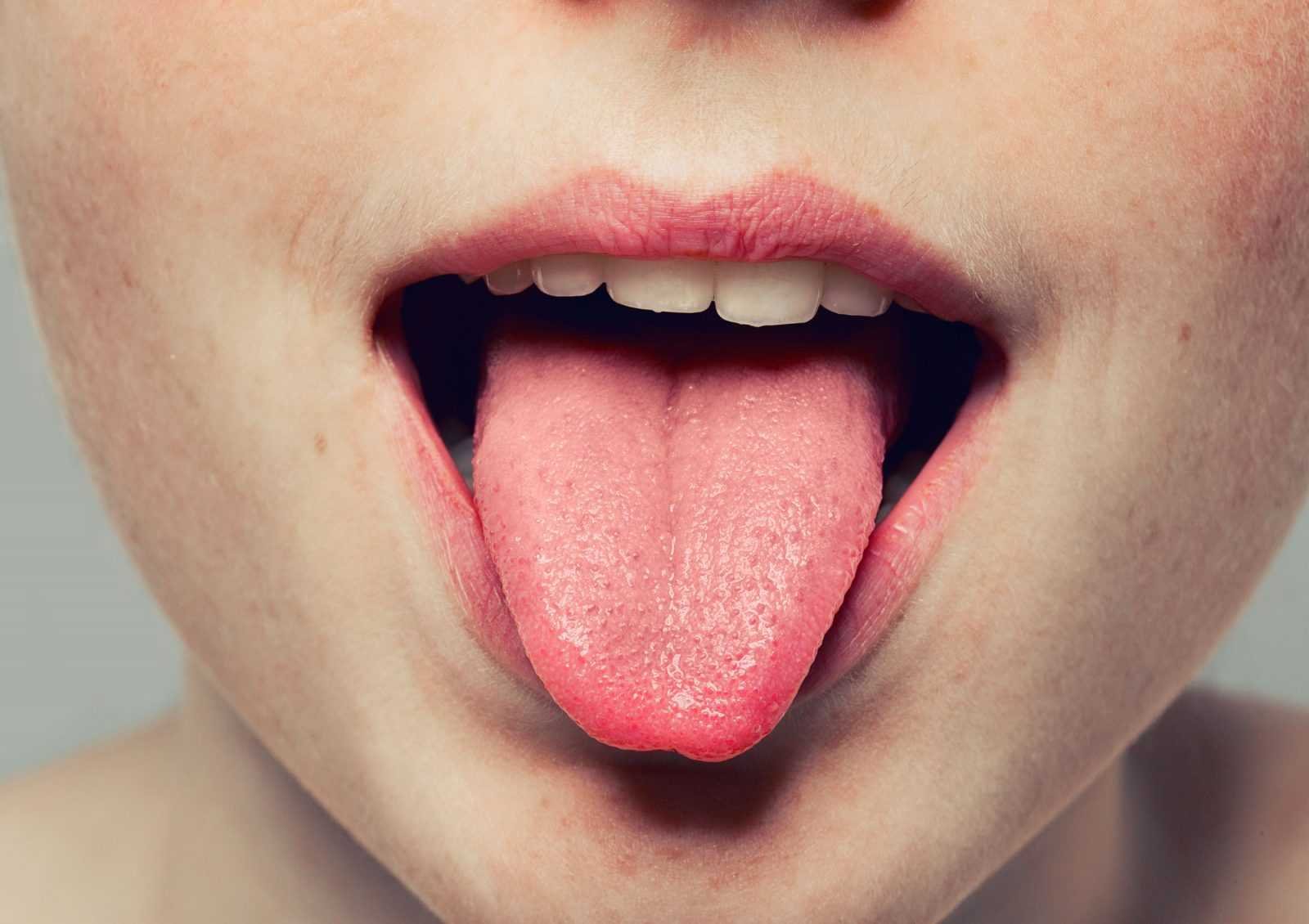 Металлический привкус во рту у мужчин причины