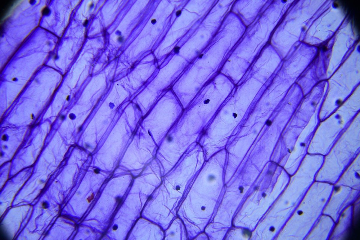 строение раст клетки под микроскопом фото 42