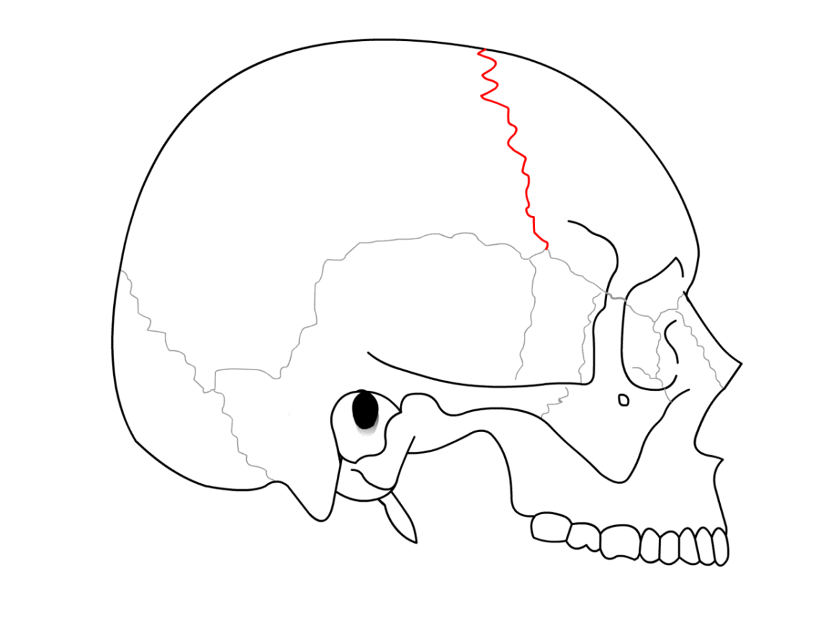 Соединение теменной кости и затылочной. Затылочно-сосцевидный шов. Сосцевидный шов черепа. Венечный шов черепа анатомия. Клиновидно-лобный шов черепа.