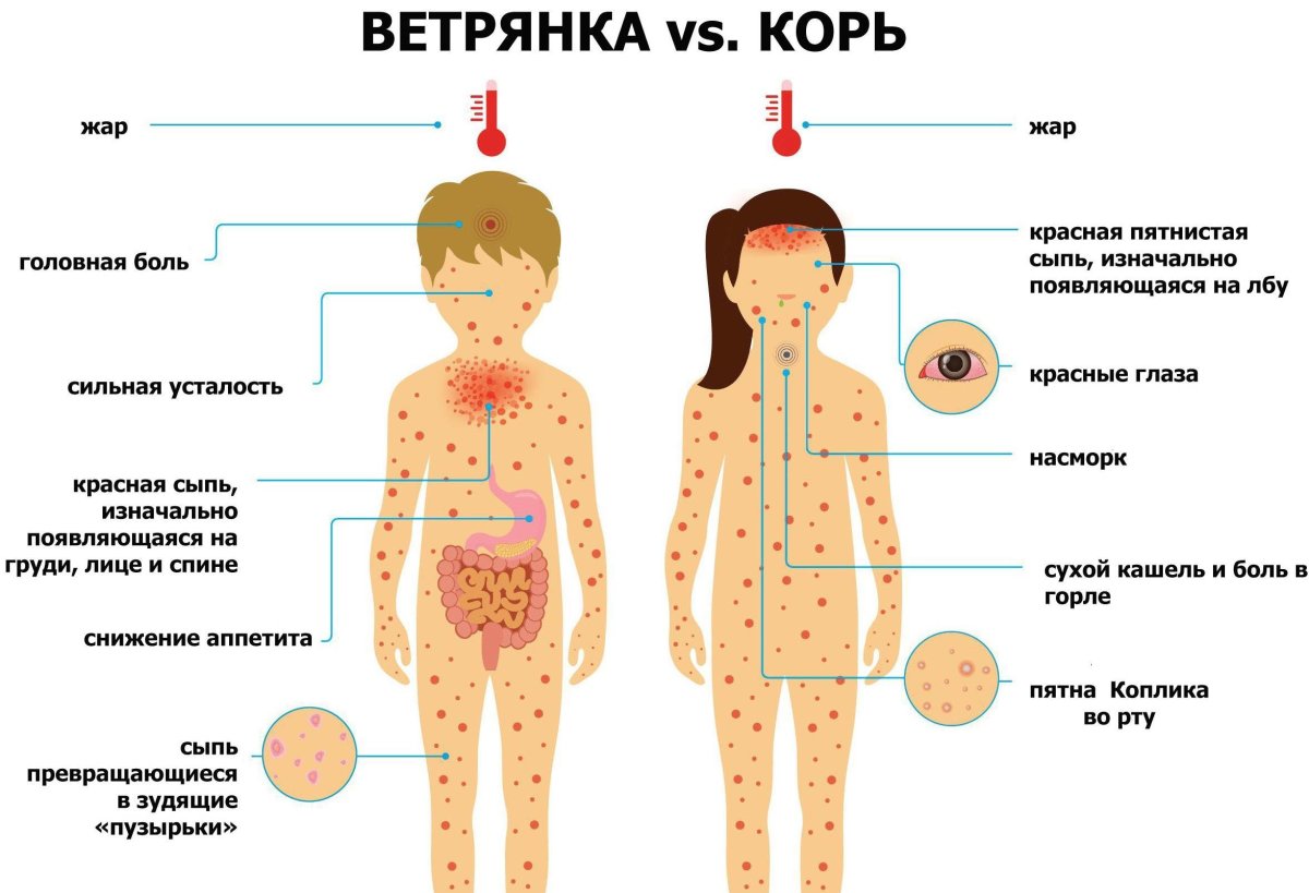 Скарлатина рисунок