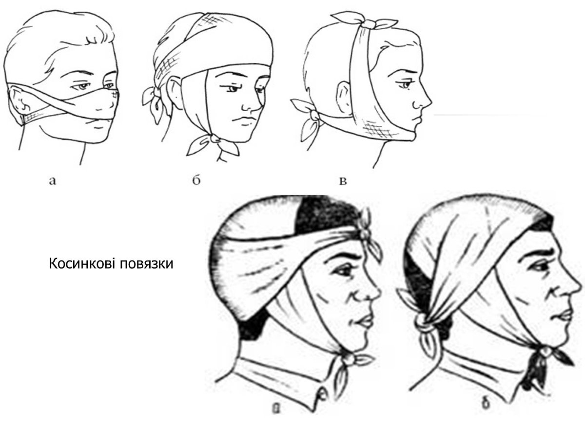 Типы бинтовых повязок рисунок