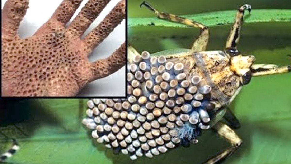 Трипофобия водяной клоп