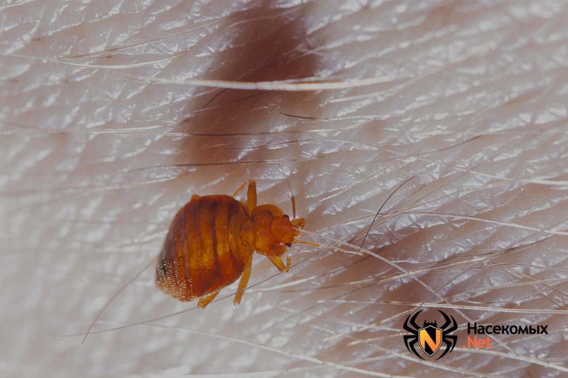 Укусы от постельных клопов