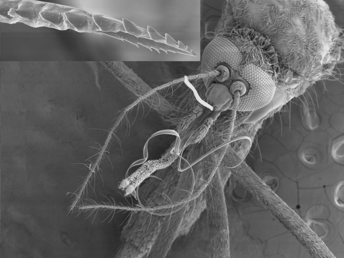 Малярийный комар под микроскопом