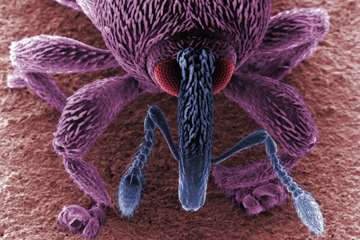 Микроробы под микроскопом