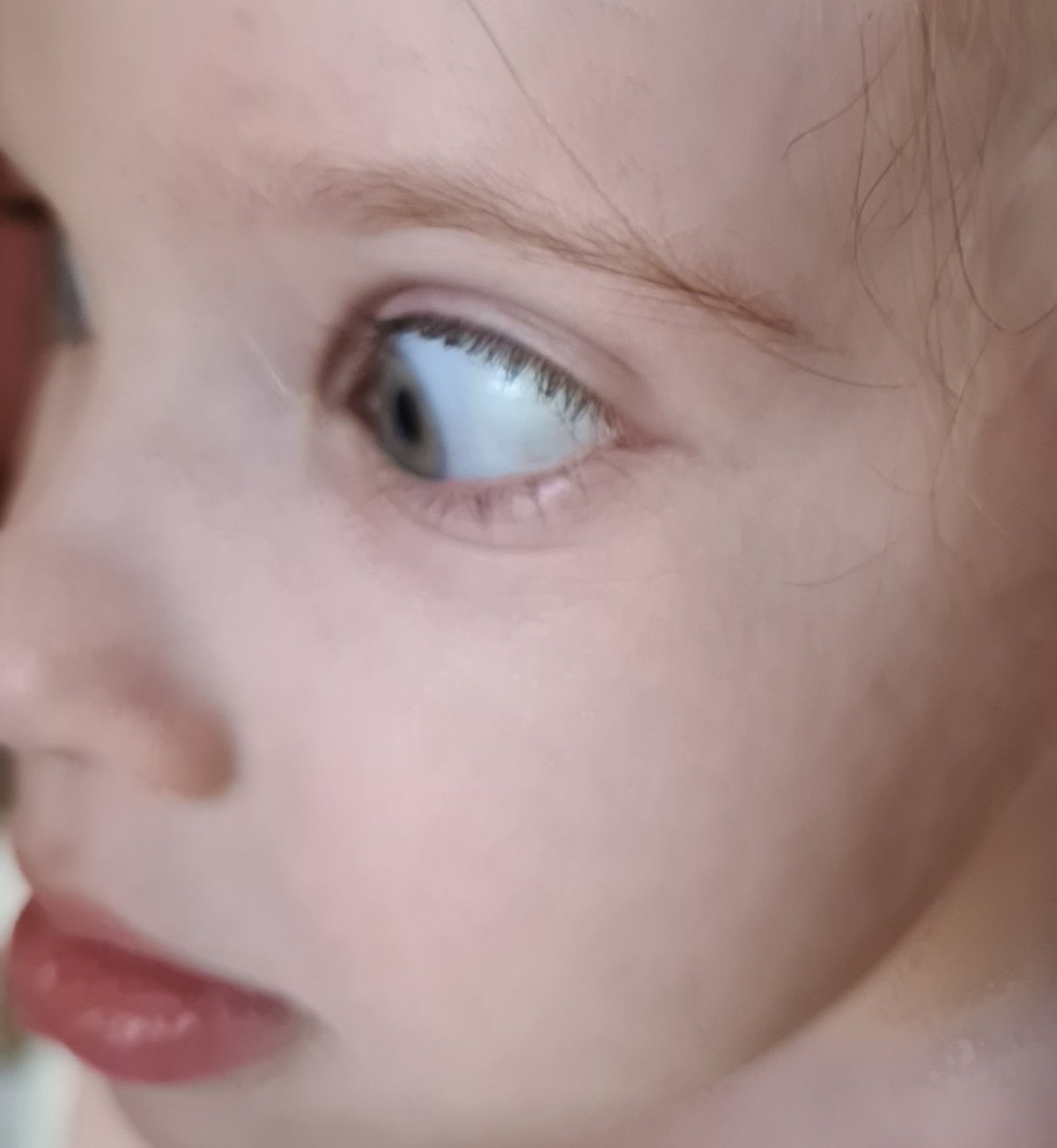 На белке глаза красные сосуды