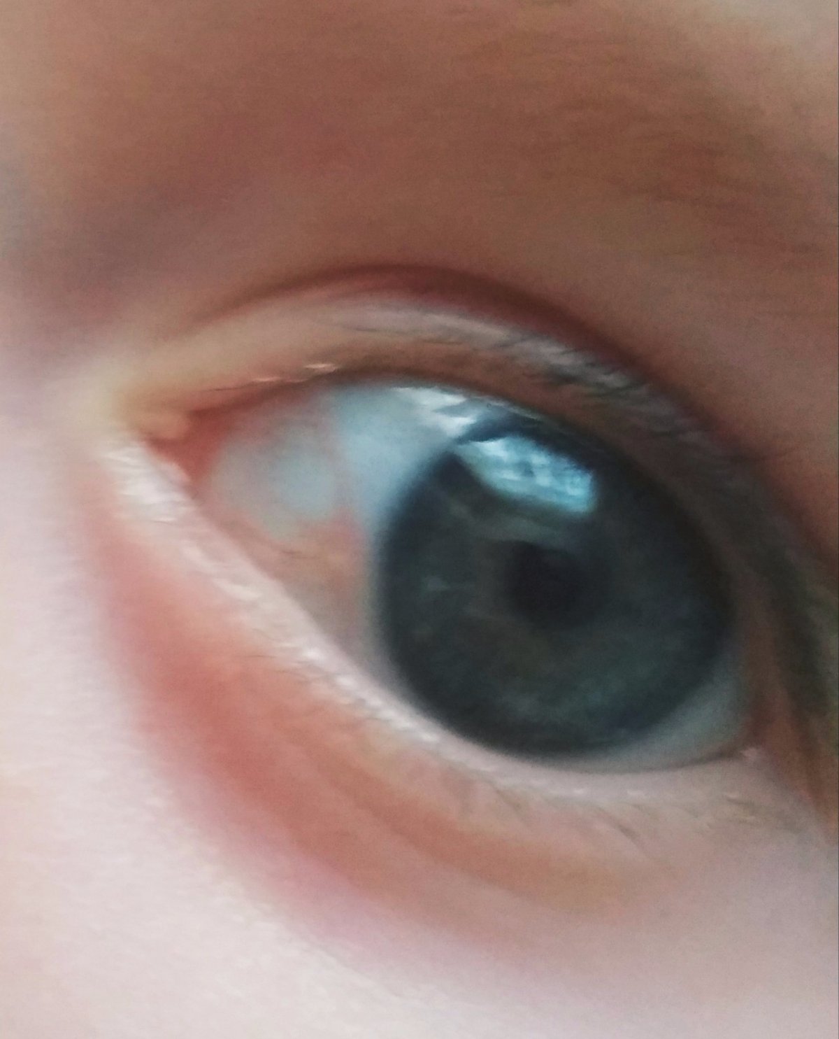 Перцем залили глаза что делать