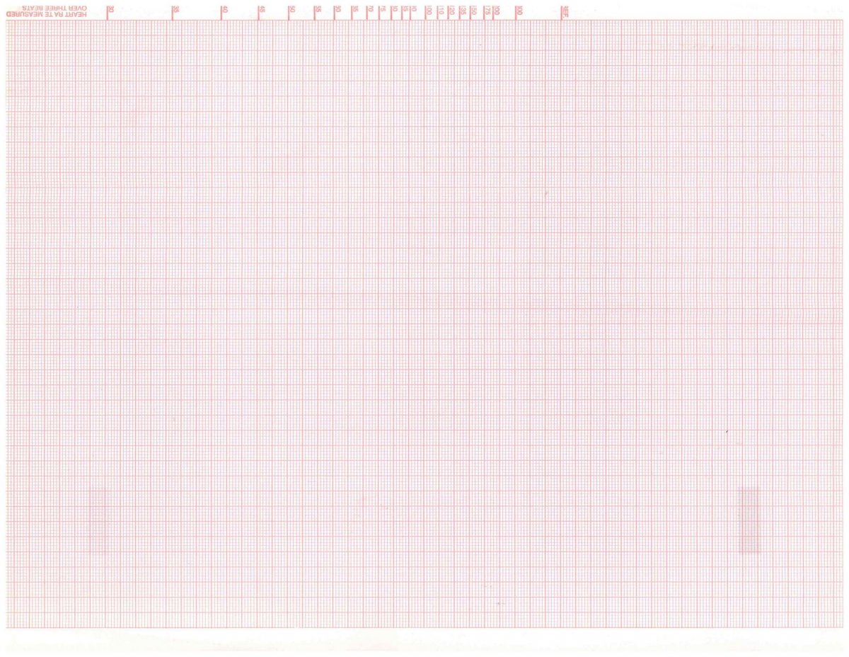 Миллиметровка Ханты