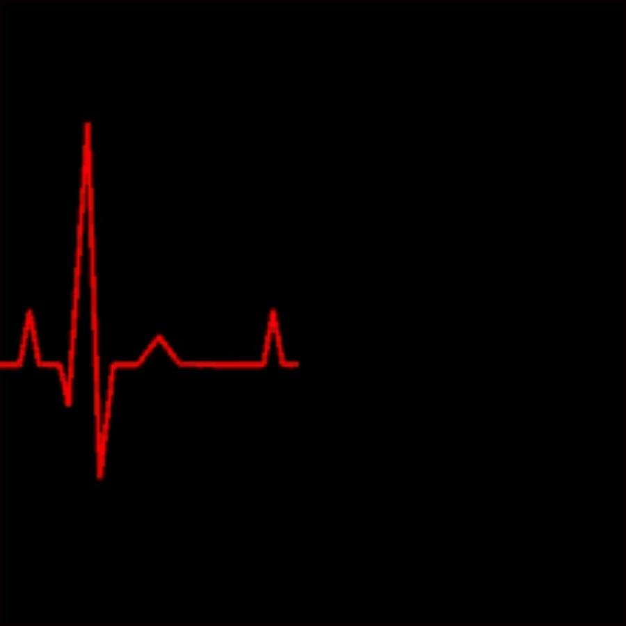 Полный концерт пульс. Кардиограмма. Кардиограмма сердца. Пульс на черном фоне. Кардиограмма gif.