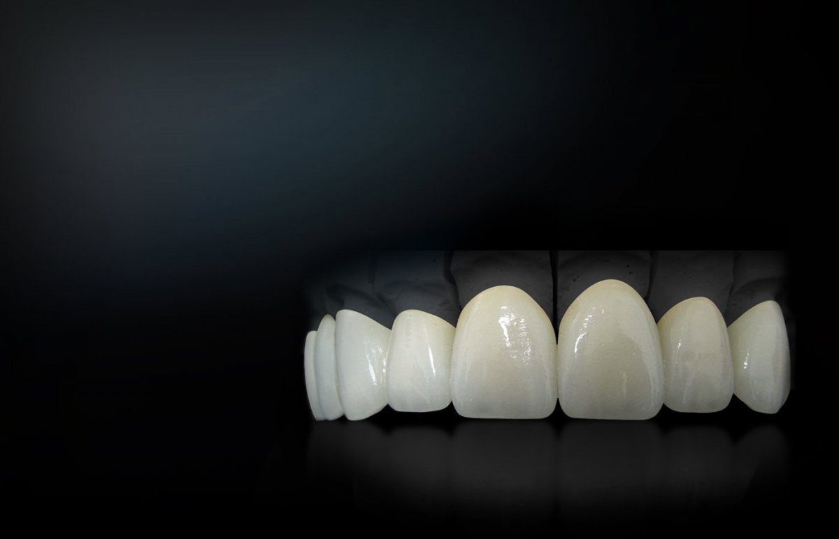 Зубы на черном фоне