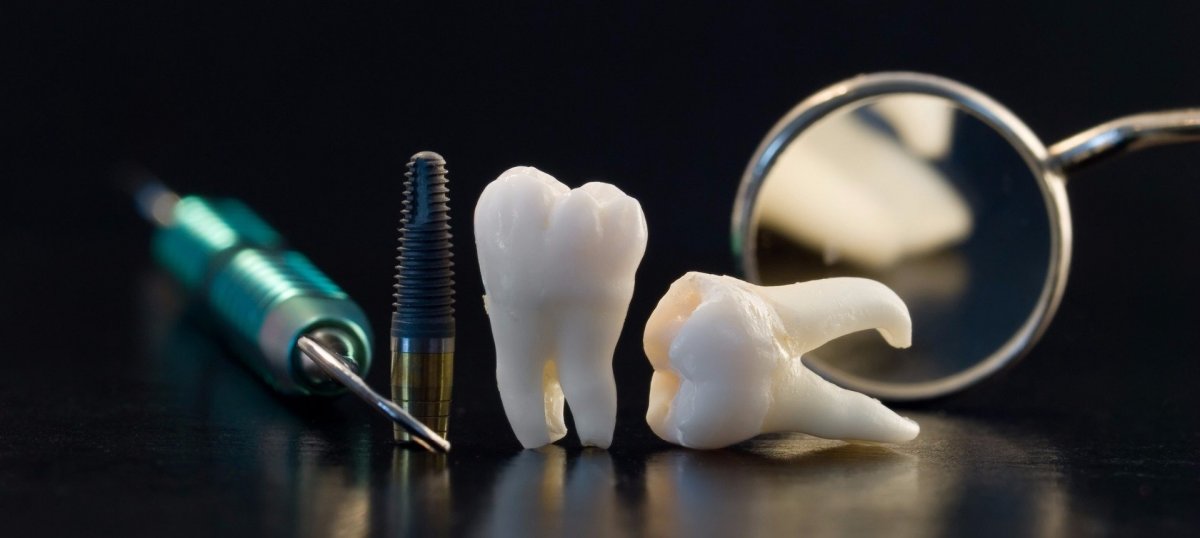 Стоматология зубы