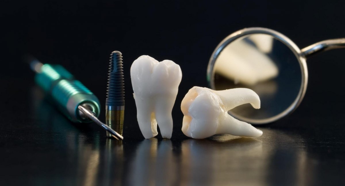 Красивые импланты