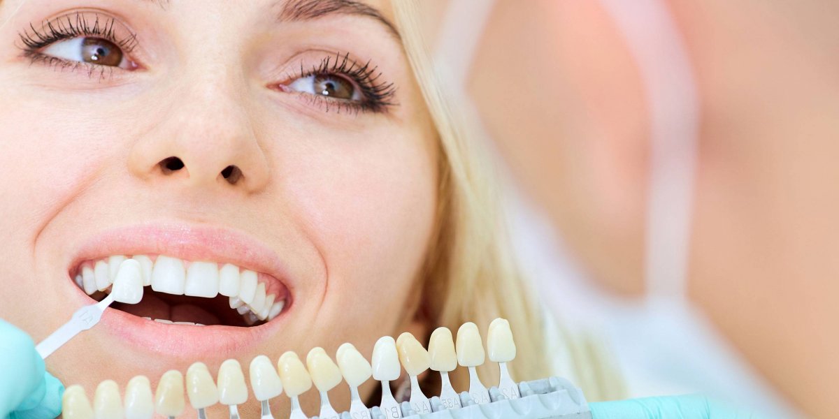 Комплексная гигиена полости рта