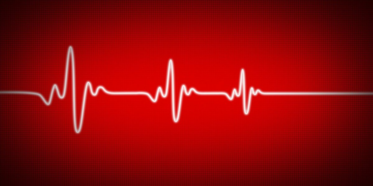 Кардиограмма остановки сердца