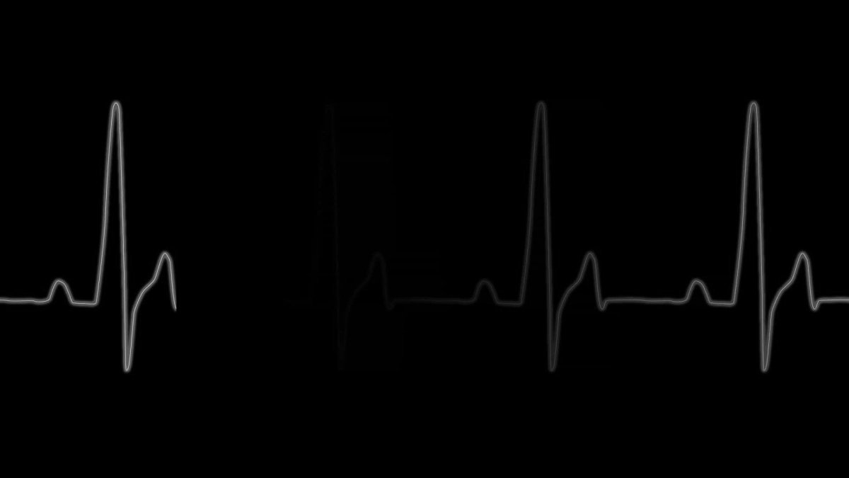 Кардиограмма на черном фоне