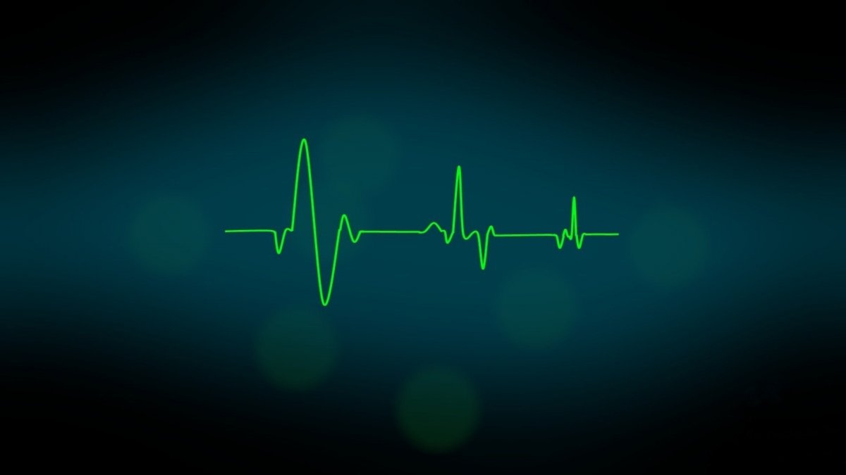 Кардиограмма сердца