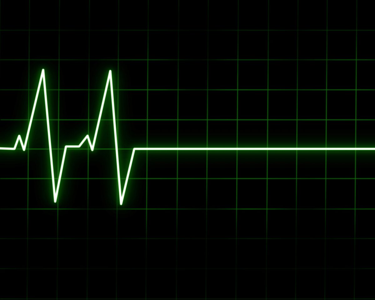 Импульс сердца