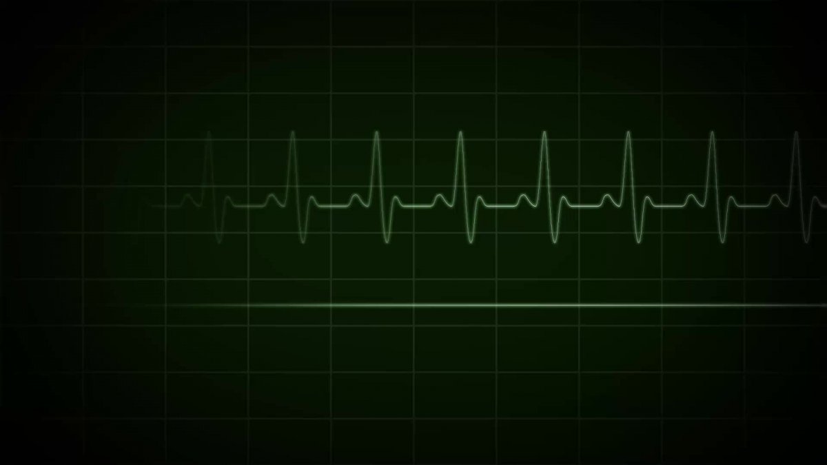 Кардиограмма фон