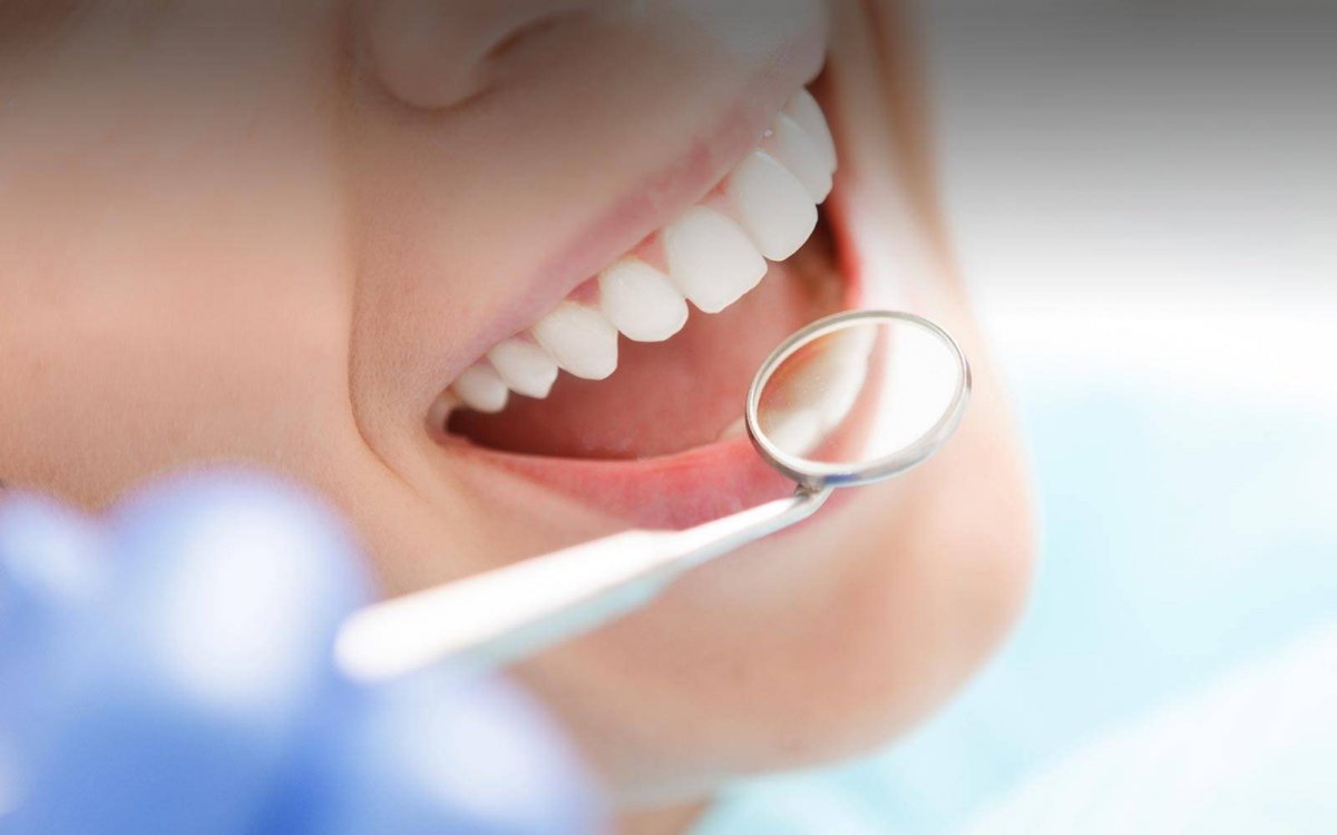 Щучья улыбка в стоматологии