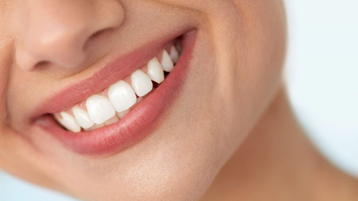 Белоснежные зубы