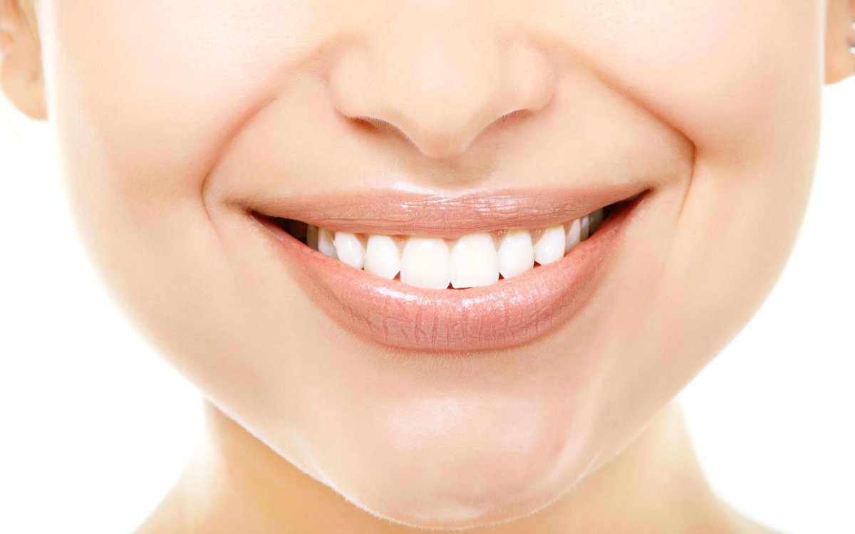 Белоснежная улыбка
