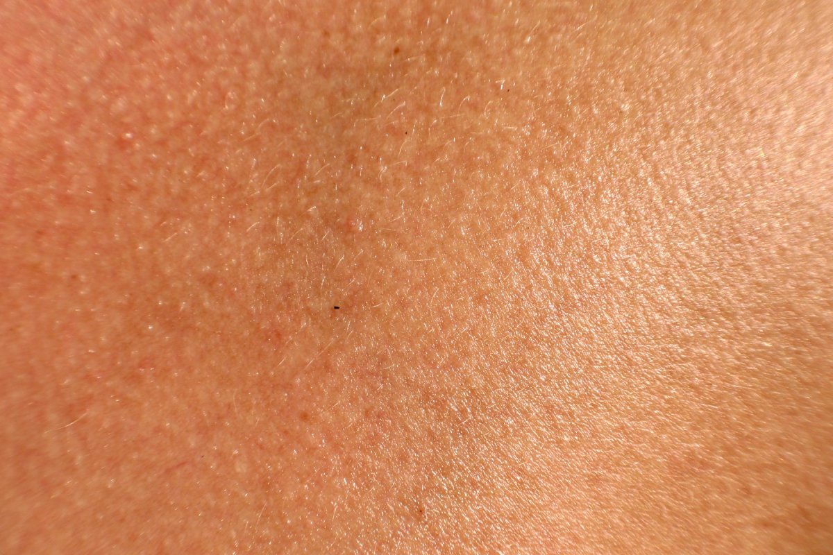 Текстура кожи