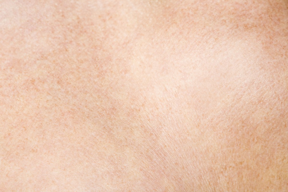 Фактура человеческой кожи