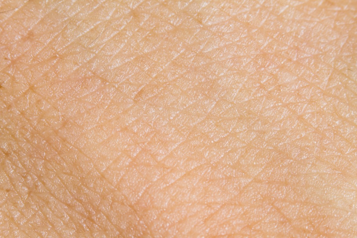 Текстура кожи тела