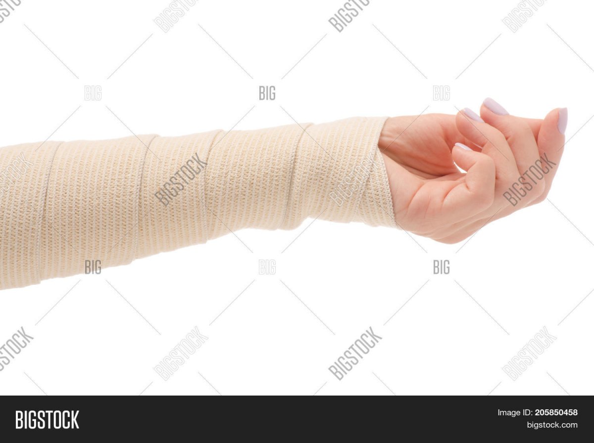 Рука в бинте эластичном женская